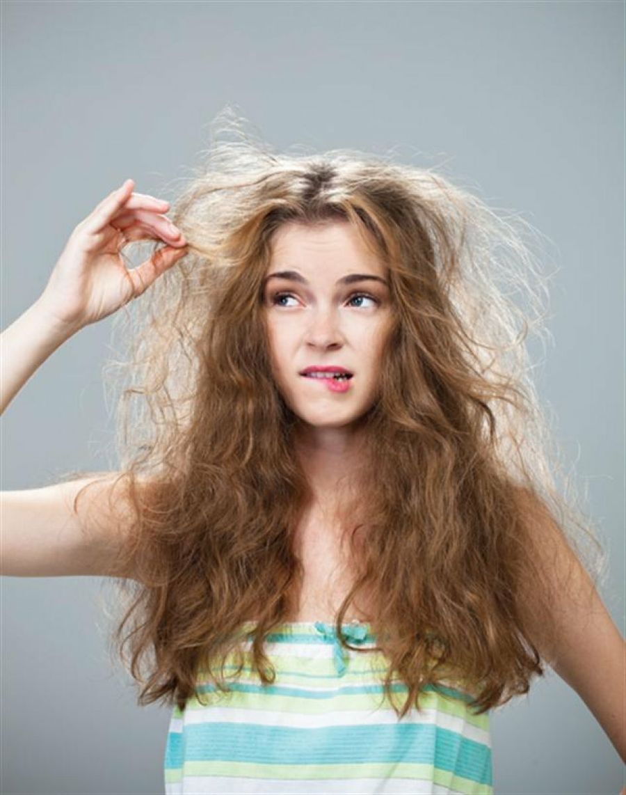 درمان ریزش مو در خانم‌ها